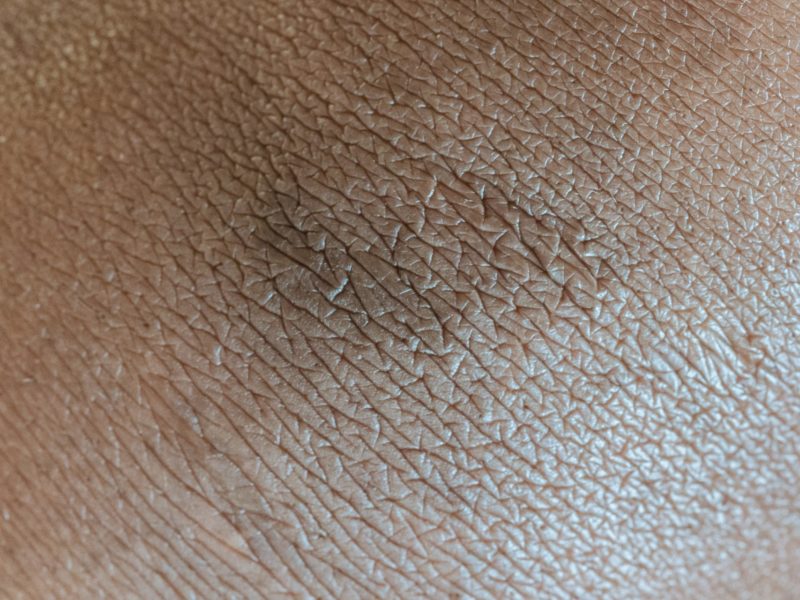 This image portrays Skin by Addiction Poetry.